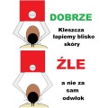 Szczypce, pęseta narzędzie do usuwania kleszczy dla kota i psa Trixie